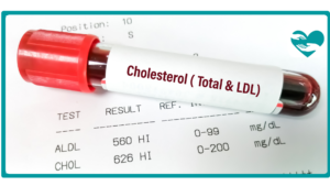 Metformin and Cholesterol How It Helps